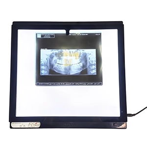 نگاتسکوپ LED دیجیتال عاج طب