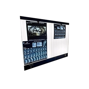 نگاتوسکوپ SM200