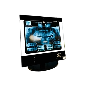 نگاتوسکوپ دندانپزشکی SM50