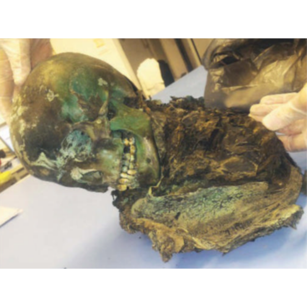 جسد پسری که در تابوت مسی مومیایی شد و به رنگ سبز درآمد