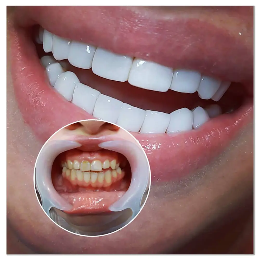 کامپوزیت سولافیل