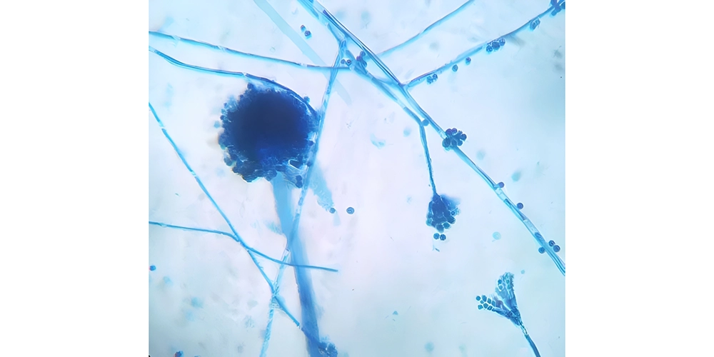 لاکتوفنل کاتن بلو