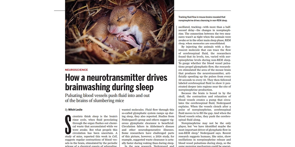 چرا خواب برای پاک سازی مغزی ضروری است؟