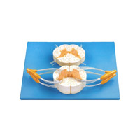 مولاژ طناب نخاعی