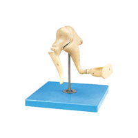 مولاژ استخوانچه گوش