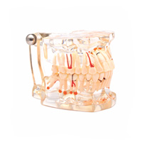 مولاژ دندان شیشه ای