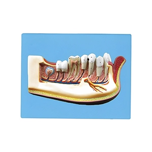 مولاژ دندان نیم فک انسان