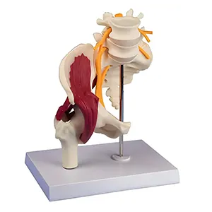 مولاژ آناتومی لگن زن با ماهیچه و عصب سیاتیک