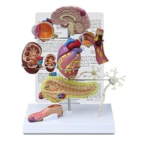 مولاژ اثرات بیماری دیابت بر ارگانها