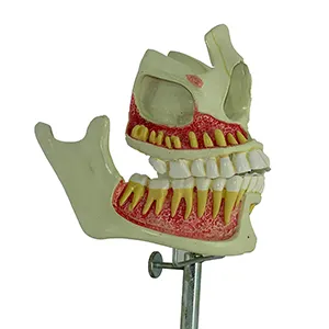 مولاژ فک و دندان