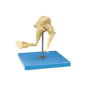 مولاژ استخوانچه شنوایی