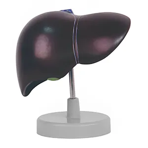 مولاژ کبد و کیسه صفرا