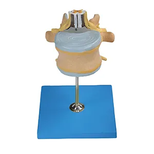 مولاژ مهره کمر با نخاع و طناب نخاعی