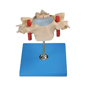 مولاژ مهره گردن با نخاع