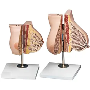 مولاژ غدد پستان